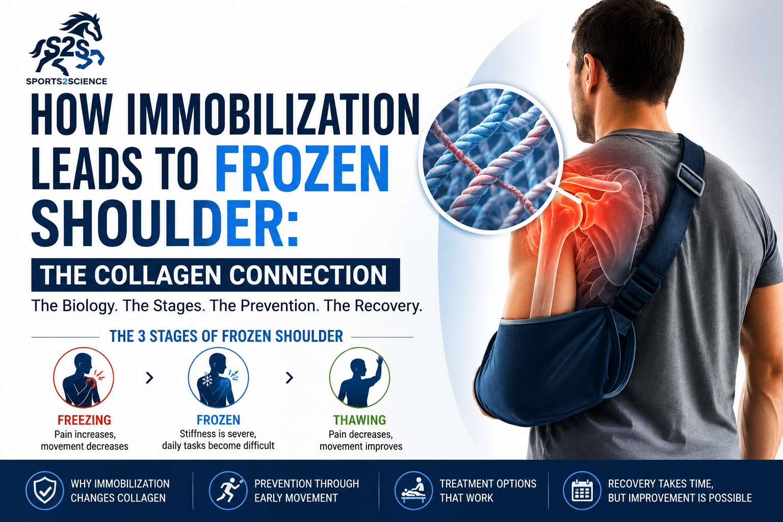 Illustration showing shoulder immobilization leading to collagen changes, capsule tightening, and frozen shoulder development